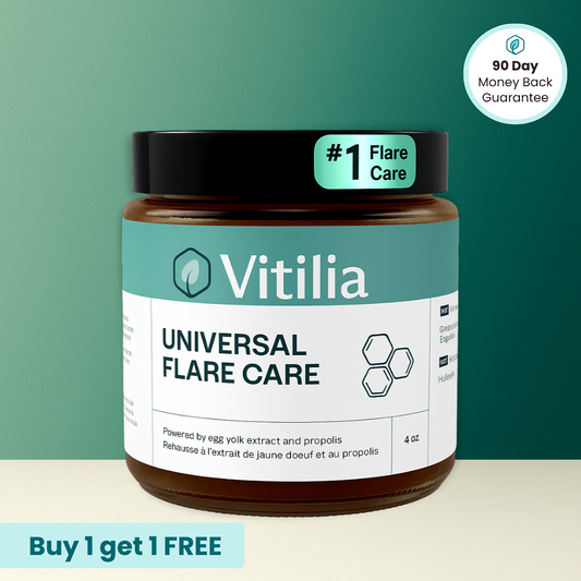 Vitilia™ Universal Flare Care