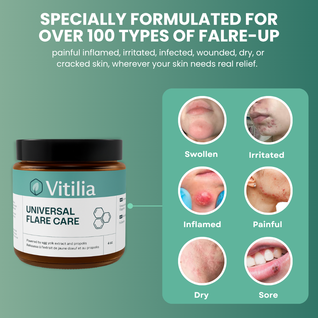 Vitilia™ Universal Flare Care