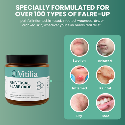 Vitilia™ Universal Flare Care