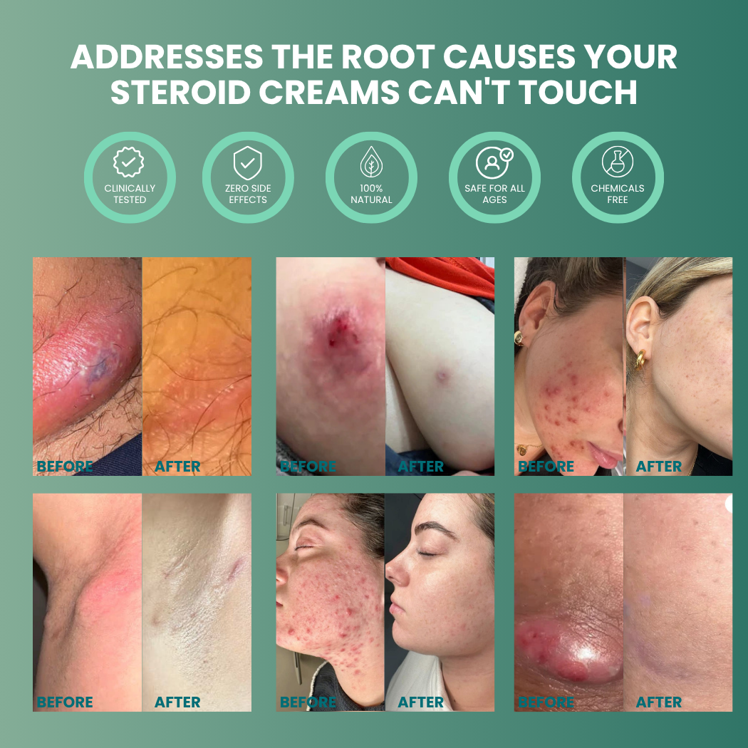 Vitilia™ Universal Flare Care