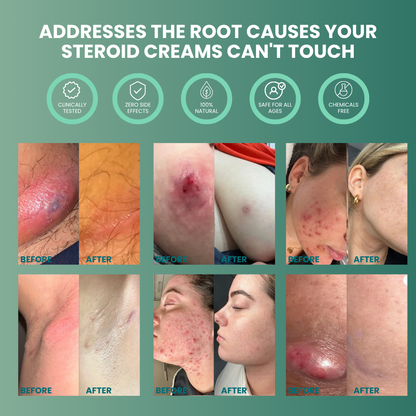 Vitilia™ Universal Flare Care